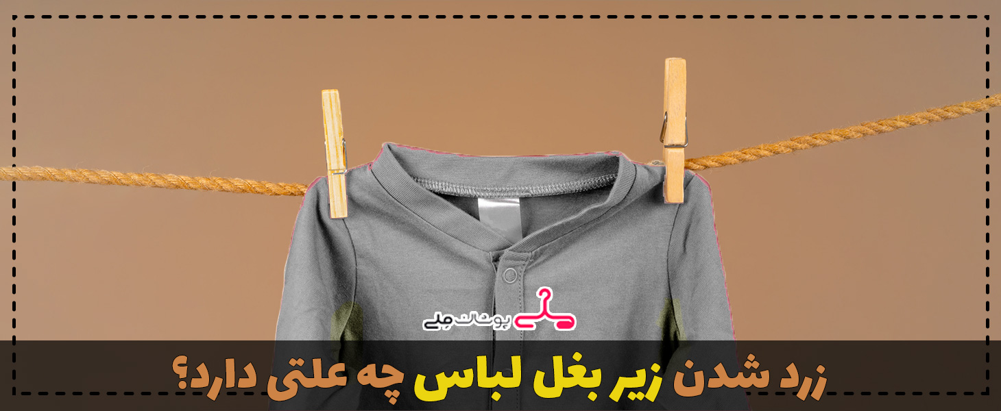 زرد شدن زیر بغل لباس چه علتی دارد؟